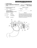 METHOD AND INSTRUMENT FOR TREATING OBESITY diagram and image