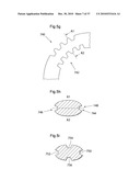 METHOD AND INSTRUMENT FOR TREATING OBESITY diagram and image