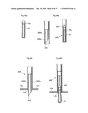 METHOD AND INSTRUMENT FOR TREATING OBESITY diagram and image