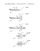 METHOD AND INSTRUMENT FOR TREATING OBESITY diagram and image