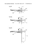 METHOD AND INSTRUMENT FOR TREATING OBESITY diagram and image