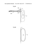 METHOD AND INSTRUMENT FOR TREATING OBESITY diagram and image