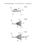 METHOD AND INSTRUMENT FOR TREATING OBESITY diagram and image