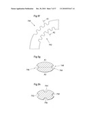 DEVICE, SYSTEM AND METHOD FOR TREATING OBESITY diagram and image