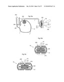 DEVICE, SYSTEM AND METHOD FOR TREATING OBESITY diagram and image