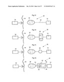 DEVICE, SYSTEM AND METHOD FOR TREATING OBESITY diagram and image