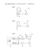 DEVICE, SYSTEM AND METHOD FOR TREATING OBESITY diagram and image