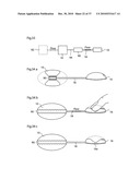 DEVICE, SYSTEM AND METHOD FOR TREATING OBESITY diagram and image