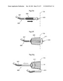 DEVICE, SYSTEM AND METHOD FOR TREATING OBESITY diagram and image