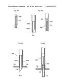 DEVICE, SYSTEM AND METHOD FOR TREATING OBESITY diagram and image