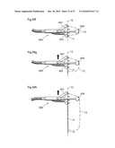 DEVICE, SYSTEM AND METHOD FOR TREATING OBESITY diagram and image