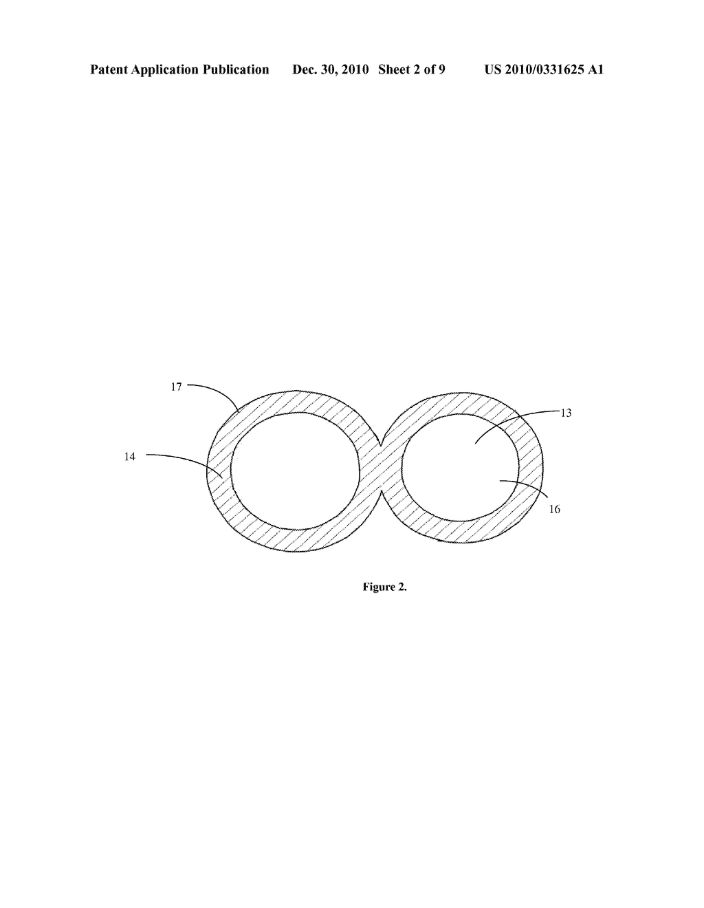 ENDOSCOPIC OVERTUBE - diagram, schematic, and image 03