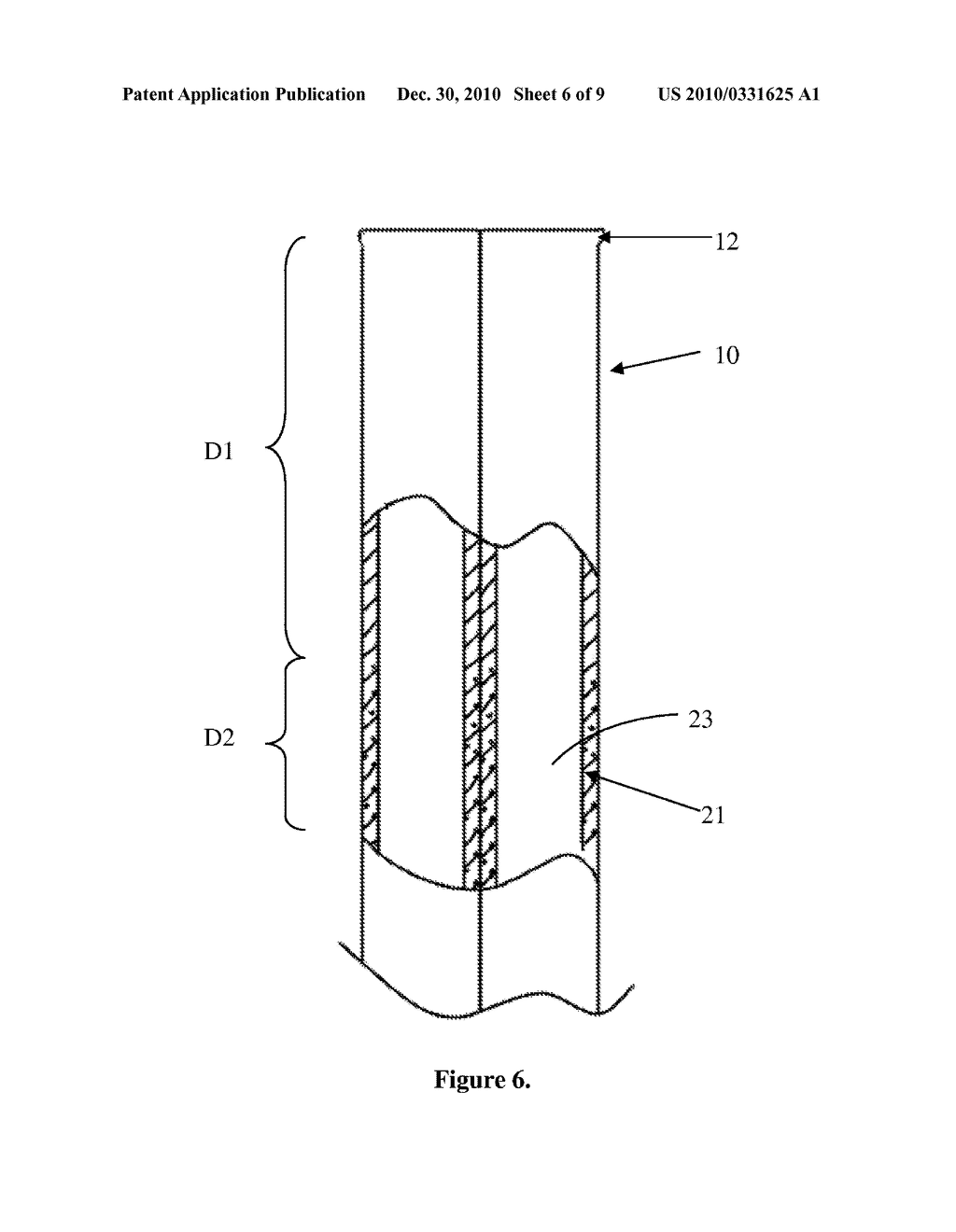 ENDOSCOPIC OVERTUBE - diagram, schematic, and image 07