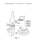 SYSTEM AND METHOD FOR SHORT RANGE TELEMETRY TO MEASURE A PARAMETER OF THE MUSCULAR-SKELETAL SYSTEM diagram and image