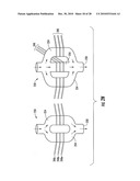 HOUSING FOR AN INTRAVASCULAR SENSOR diagram and image