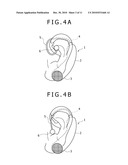 AURICLE-INSTALLED DEVICE AND BIO-SIGNAL MEASUREMENT APPARATUS diagram and image