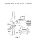 SENSING MODULE FOR ORTHOPEDIC LOAD SENSING INSERT DEVICE diagram and image