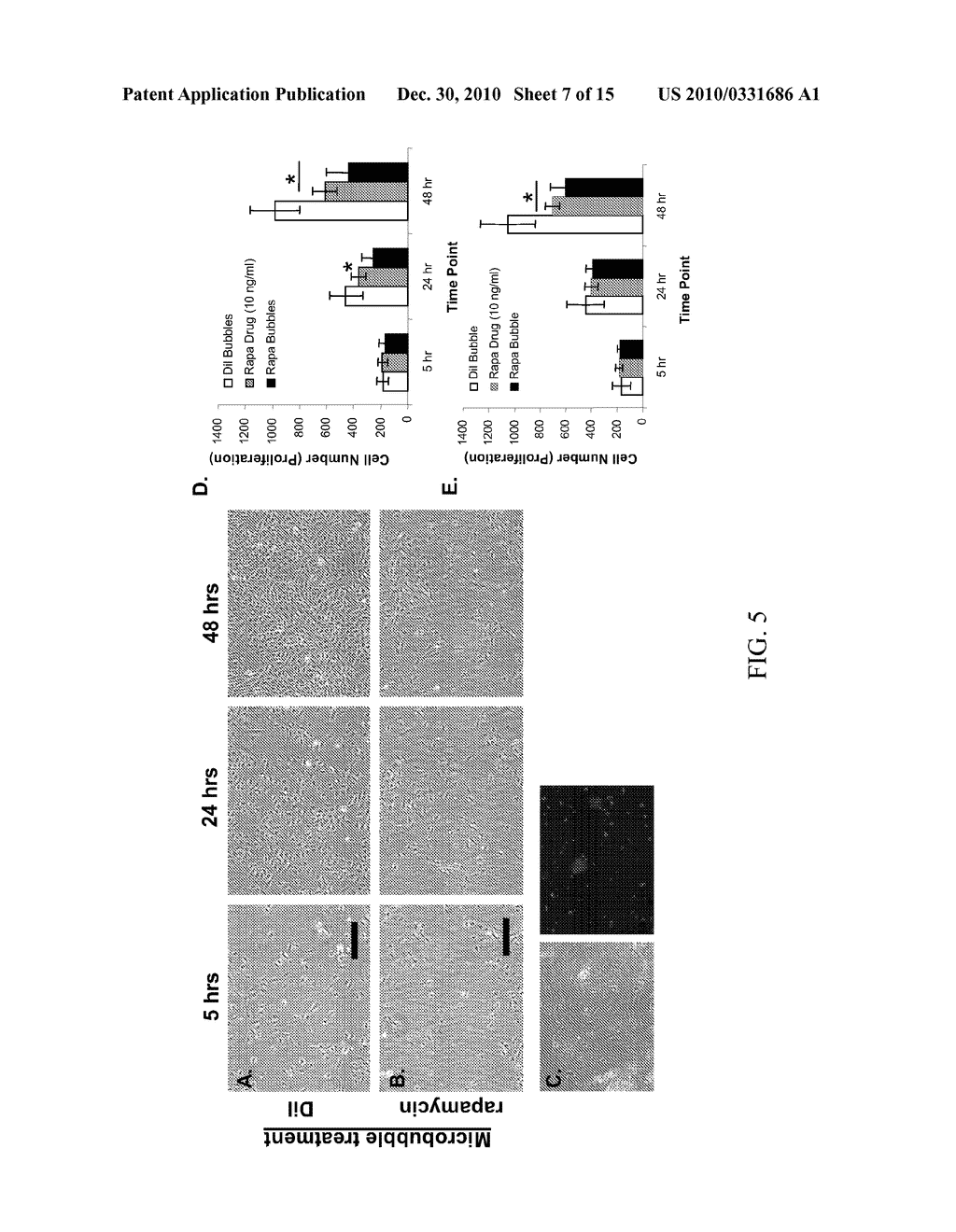 System for Treatment and Imaging Using Ultrasonic Energy and Microbubbles and Related Method Thereof - diagram, schematic, and image 08