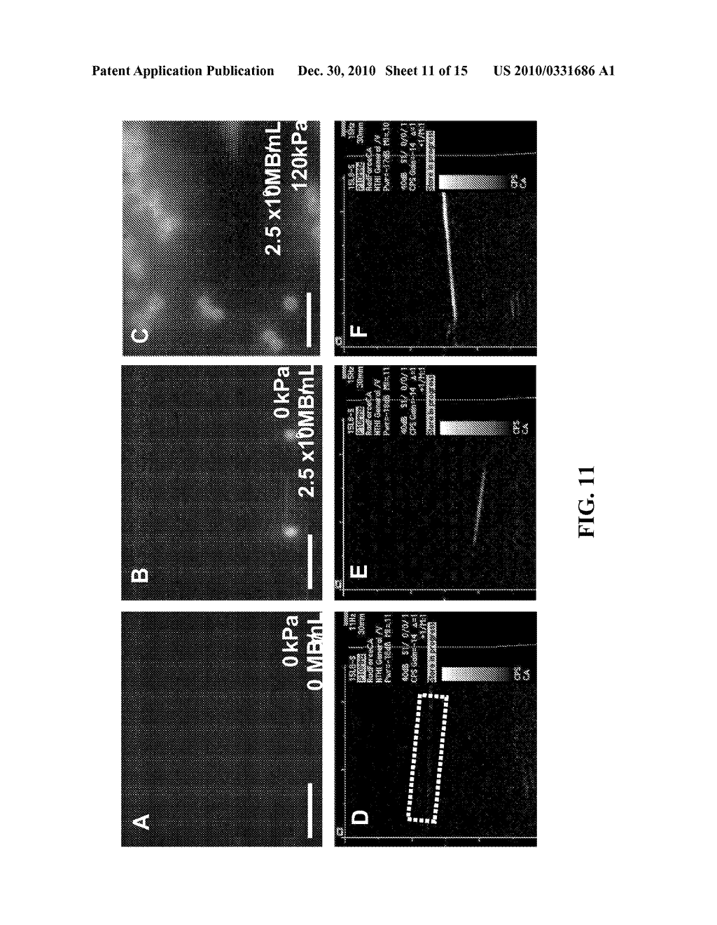 System for Treatment and Imaging Using Ultrasonic Energy and Microbubbles and Related Method Thereof - diagram, schematic, and image 12