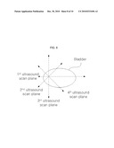 APPARATUS AND METHOD FOR AUTOMATICALLY MEASURING THE VOLUME OF URINE IN A BLADDER USING ULTRASOUND SIGNALS diagram and image