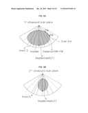 APPARATUS AND METHOD FOR AUTOMATICALLY MEASURING THE VOLUME OF URINE IN A BLADDER USING ULTRASOUND SIGNALS diagram and image