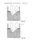 BLOOD AND INTERSTITIAL FLUID SAMPLING DEVICE diagram and image