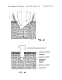 BLOOD AND INTERSTITIAL FLUID SAMPLING DEVICE diagram and image