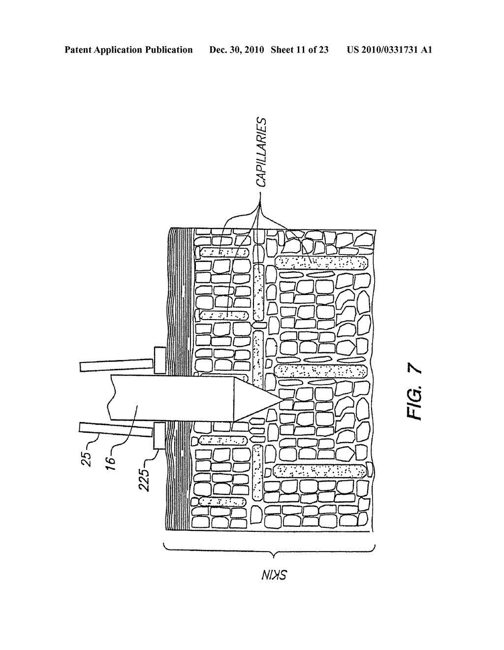 BLOOD AND INTERSTITIAL FLUID SAMPLING DEVICE - diagram, schematic, and image 12