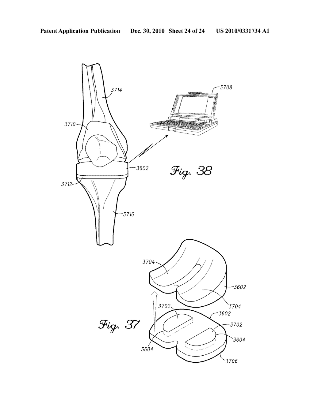 SYSTEM AND METHOD FOR ORTHOPEDIC LOAD SENSING INSERT DEVICE - diagram, schematic, and image 25