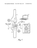 INTEGRATED SENSOR AND INTERCONNECT FOR MEASURING A PARAMETER OF THE MUSCULAR-SKELETAL SYSTEM diagram and image