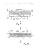 INTEGRATED SENSOR AND INTERCONNECT FOR MEASURING A PARAMETER OF THE MUSCULAR-SKELETAL SYSTEM diagram and image