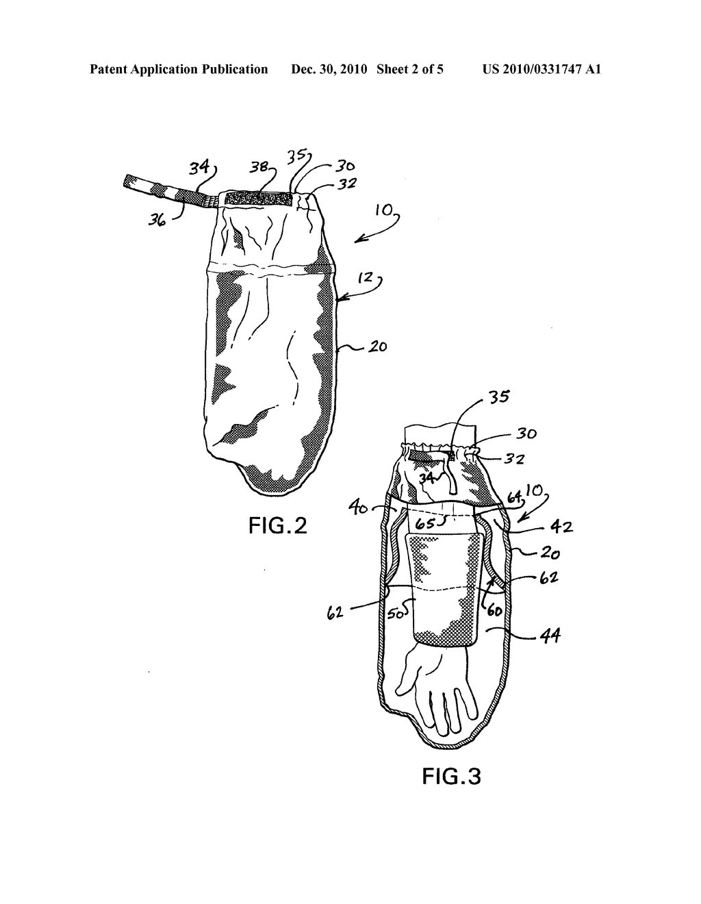 Protective cast cover for bathing - diagram, schematic, and image 03