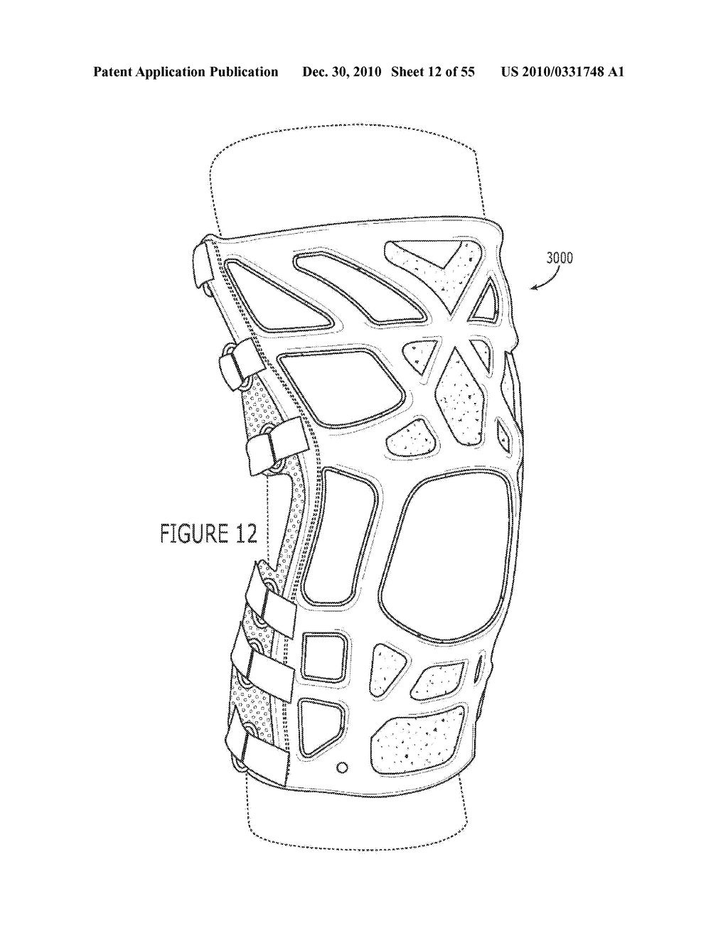 DONNING POTENTIATING SUPPORT WITH EXPANDABLE FRAMEWORK FASTENED TO GARMENT - diagram, schematic, and image 13