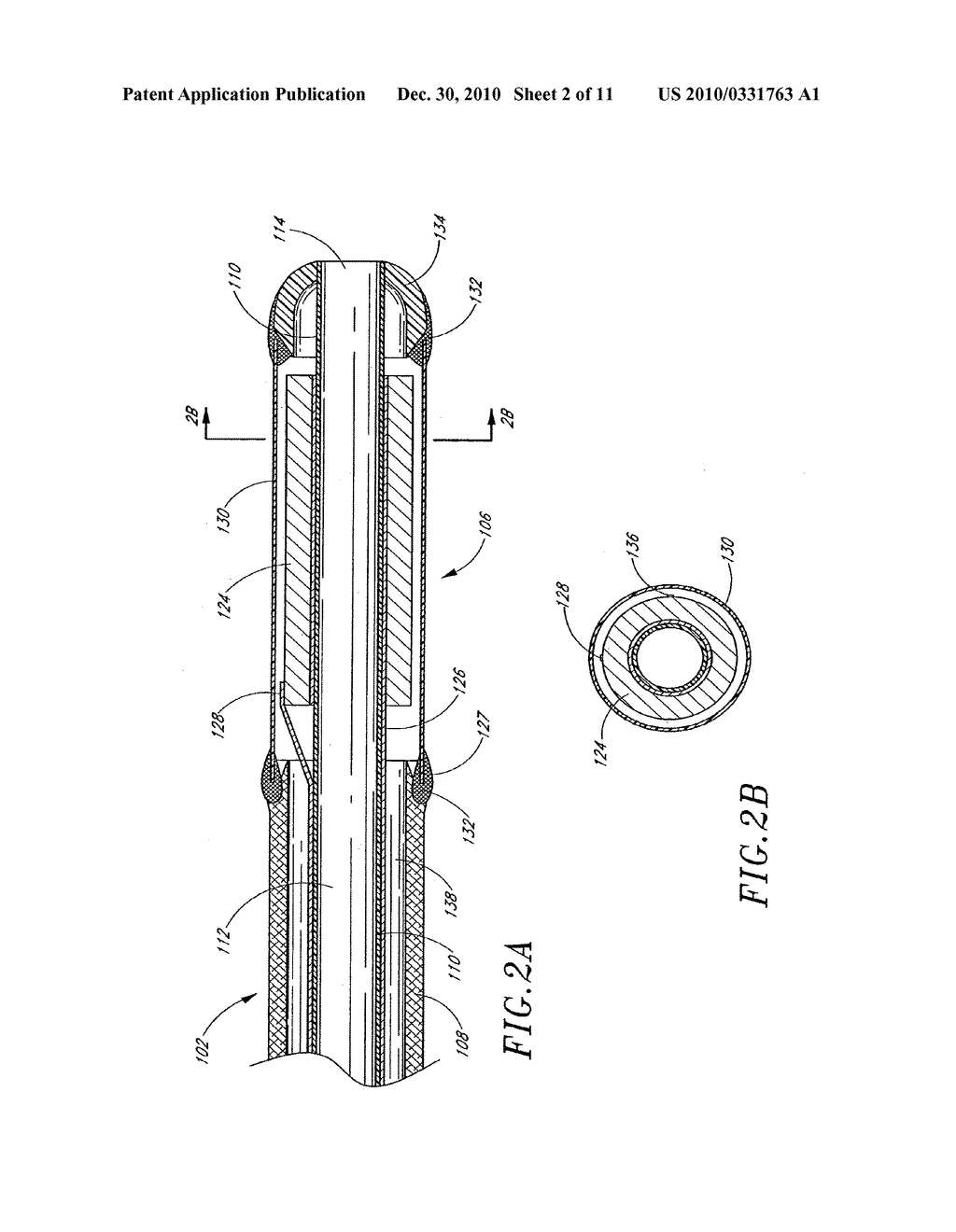 ULTRASOUND CATHETER WITH EMBEDDED CONDUCTORS - diagram, schematic, and image 03