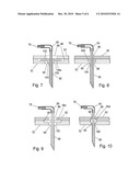 APPARATUS FOR INFUSING LIQUID TO A BODY diagram and image