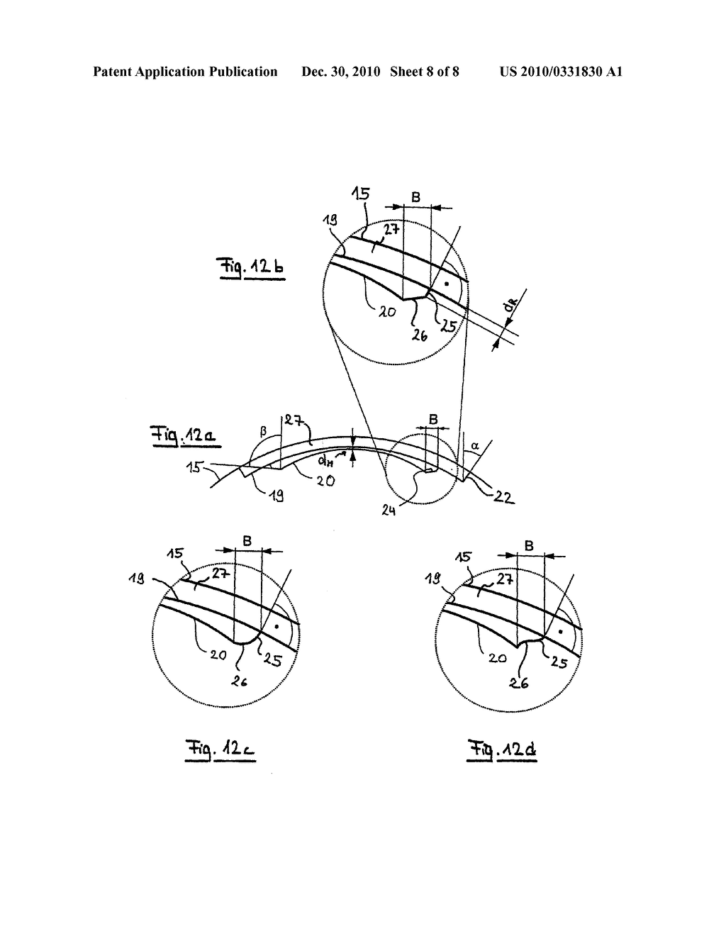 TREATMENT DEVICE FOR SURGICALLY CORRECTING AMETROPIA OF AN EYE AND METHOD FOR CREATING CONTROL DATA THEREFORE - diagram, schematic, and image 09