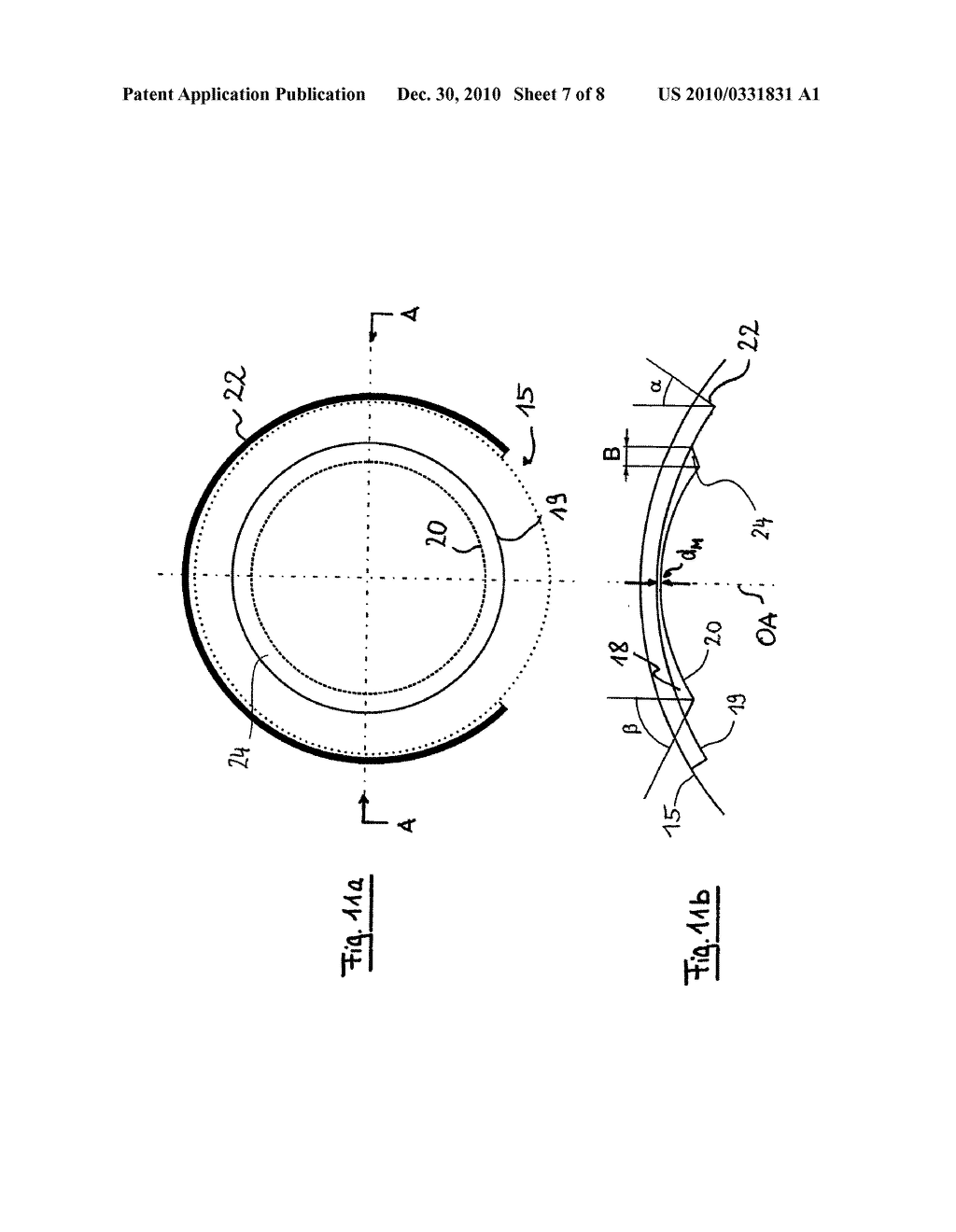 TREATMENT DEVICE FOR OPERATIVELY CORRECTING DEFECTIVE VISION OF AN EYE, METHOD FOR PRODUCING CONTROL DATA THEREFOR AND METHOD FOR OPERATIVELY CORRECTING DEFECTIVE VISION OF AN EYE - diagram, schematic, and image 08