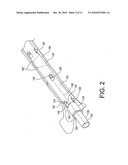 Bone fracture treatment devices and methods of their use diagram and image