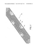 Bone fracture treatment devices and methods of their use diagram and image