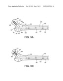 Bone fracture treatment devices and methods of their use diagram and image