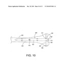 Bone fracture treatment devices and methods of their use diagram and image