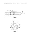 ULTRASONIC SURGICAL INSTRUMENTS diagram and image