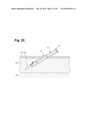 METHOD FOR CONSTRUCTING AN INSTRUMENT WITH A COVERED BORE FOR SUBCUTANEOUS IMPLANTATION diagram and image