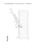 METHOD FOR CONSTRUCTING AN INSTRUMENT WITH A COVERED BORE FOR SUBCUTANEOUS IMPLANTATION diagram and image