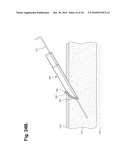 METHOD FOR CONSTRUCTING AN INSTRUMENT WITH A COVERED BORE FOR SUBCUTANEOUS IMPLANTATION diagram and image