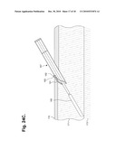 METHOD FOR CONSTRUCTING AN INSTRUMENT WITH A COVERED BORE FOR SUBCUTANEOUS IMPLANTATION diagram and image