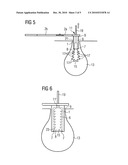 METHOD AND DEVICE FOR REMOVING A BALLOON FROM A BODY CAVITY diagram and image