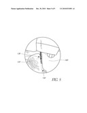 SYSTEM AND METHOD FOR SPINAL FIXATION diagram and image