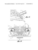 BONE REPAIR SYSTEM AND METHOD diagram and image