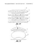 BONE REPAIR SYSTEM AND METHOD diagram and image